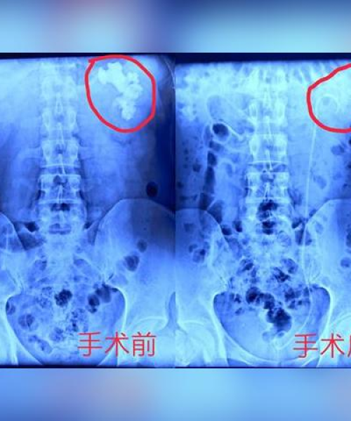 河南天铸消防，长沙集会事件视频纪实，关注社会热点